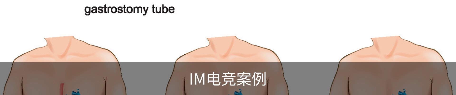 IM电竞案例